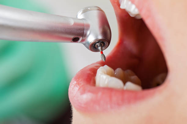 Best Pediatric Emergency Dentist in North Potomac, MD